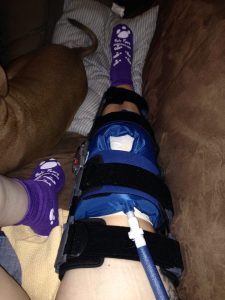 My knee brace